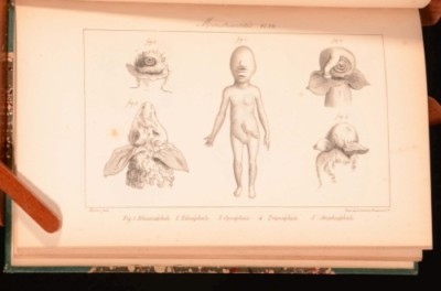 1837 Histoire Generale Particuliere Des Anomalies Atlas Geoffroy Saint-Hilaire-image
