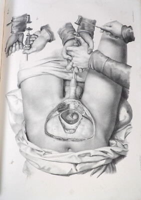 BOURGERY Complete Treatise Anatomy Man MEDICINE SURGERY EO TEXT + ATLAS 1840-image