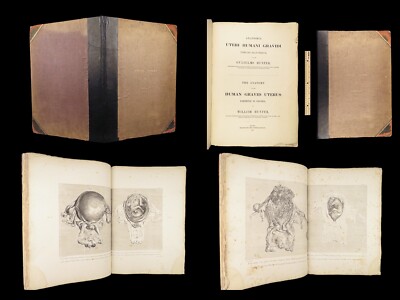 1851 Anatomy of Gravid Obstetrics OBGYN Medicine Atlas ENORMOUS FOLIO Hunter-image